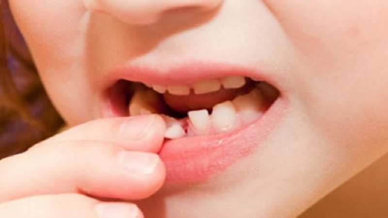 Mơ Thấy Gãy Răng: Giải Mã Giấc Mơ và Ý Nghĩa Tâm Linh 1 Ý nghĩa tâm lý của giấc mơ thấy gãy răng